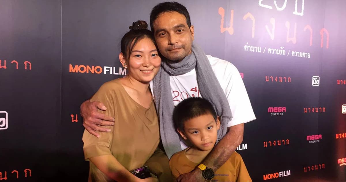 เมฆ วินัย ไกรบุตร เผยอาการป่วยโรคตุ่มน้ำพองดีขึ้น