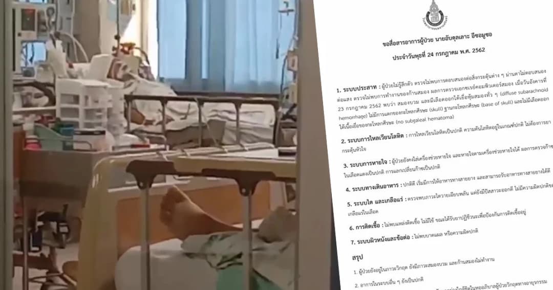 มอ.รายงานอาการ “อับดุลเลาะ” อยู่ในภาวะวิกฤต ก้านสมองไม่ทำงาน