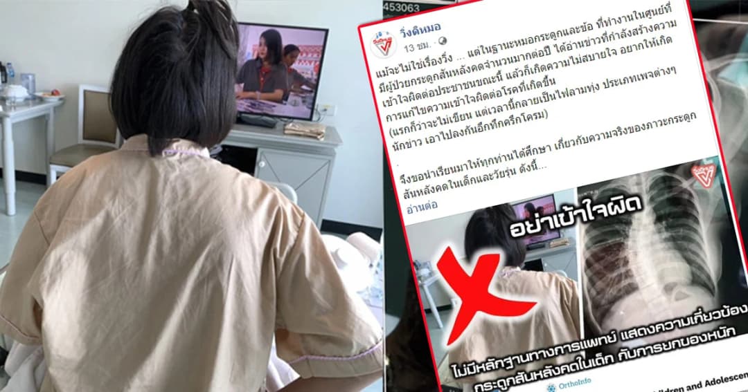 หมอกระดูก ชี้ กระเป๋านักเรียนหนักอาจไม่ใช้สาเหตุ นร.14 กระดูกสันหลังคด