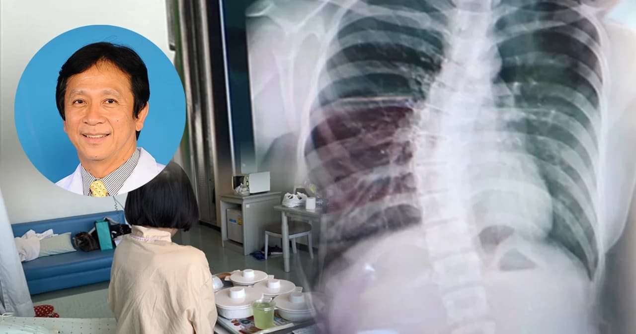 แพทย์เฉพาะทางโรคเด็กชี้ แบกกระเป๋าหนักไม่ทำกระดูกสันหลังคด