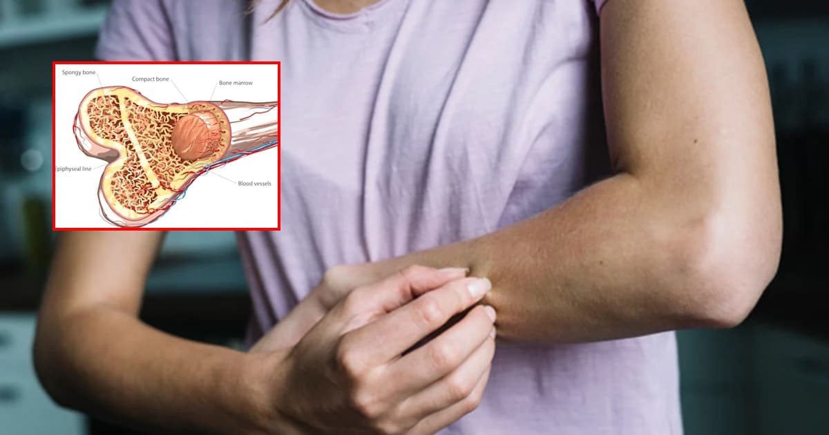 กรมการแพทย์ เผย โรคไขกระดูกฝ่อ อันตรายถึงขั้นหัวใจล้มเหลว