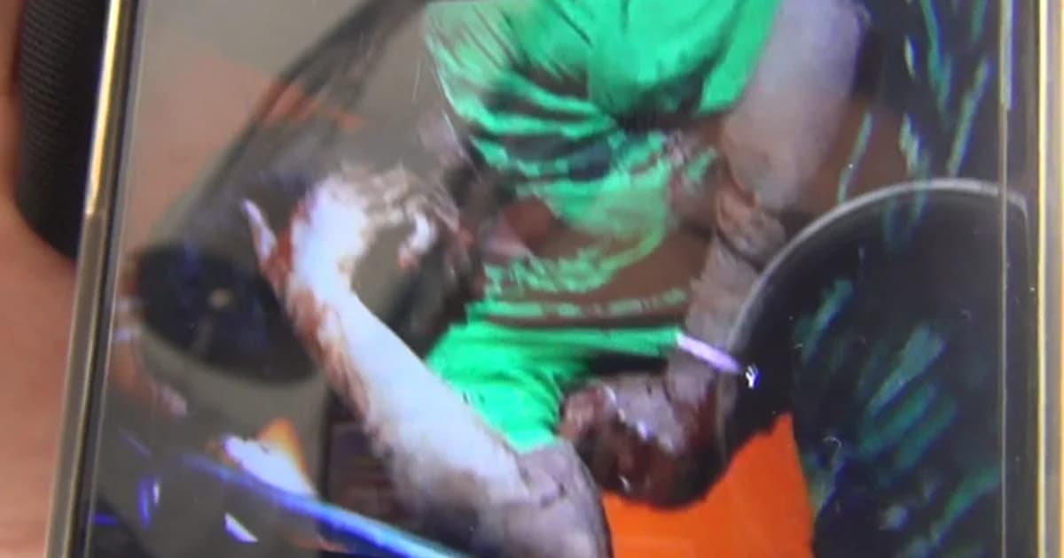 มอบตัวแล้วหนุ่มหึงโหด น้ำมันราดเผาแฟนทั้งเป็น