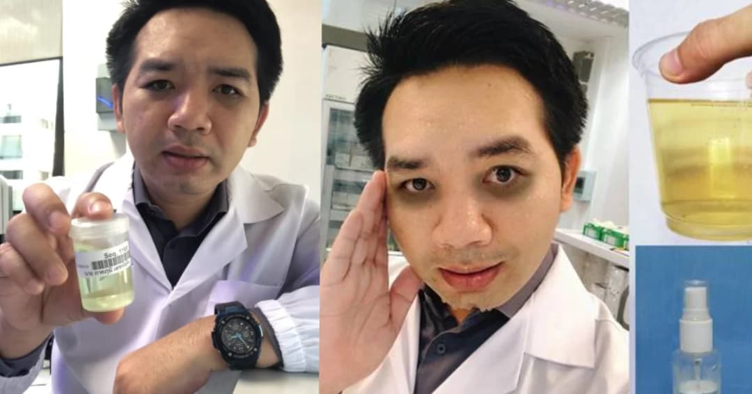 “หมอแล็บ” อัดคลิปเตือนเลิกกิน “ปัสสาวะ” ทาหน้าไร้ประโยชน์ น้อยกว่ากินข้าวหนึ่งคำ