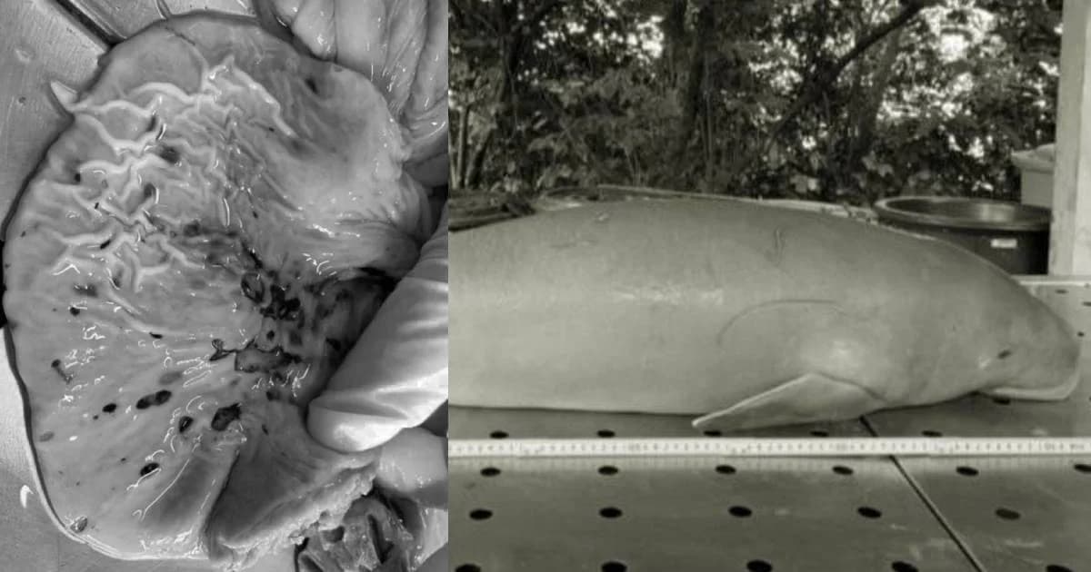 ผลชันสูตร “ยามีล” กล้ามเนื้อหัวใจขาดเลือด-ช็อกจากพิษติดเชื้อแทรกซ้อนลามทั่วตัว