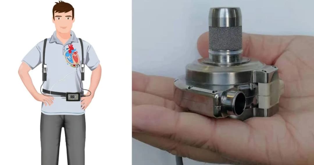 จีนใช้เทคโนโลยีอวกาศผลิต ‘หัวใจเทียม’ เล็ก เบา ถูก หวังช่วยผู้ป่วยโรคหัวใจนับล้าน