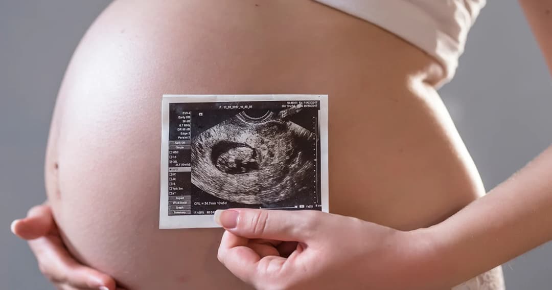 นักวิจัยเบลเยียม พบอนุภาคฝุ่นจากมลพิษทางอากาศ ในรกของมารดาด้านที่ติดกับตัวทารก