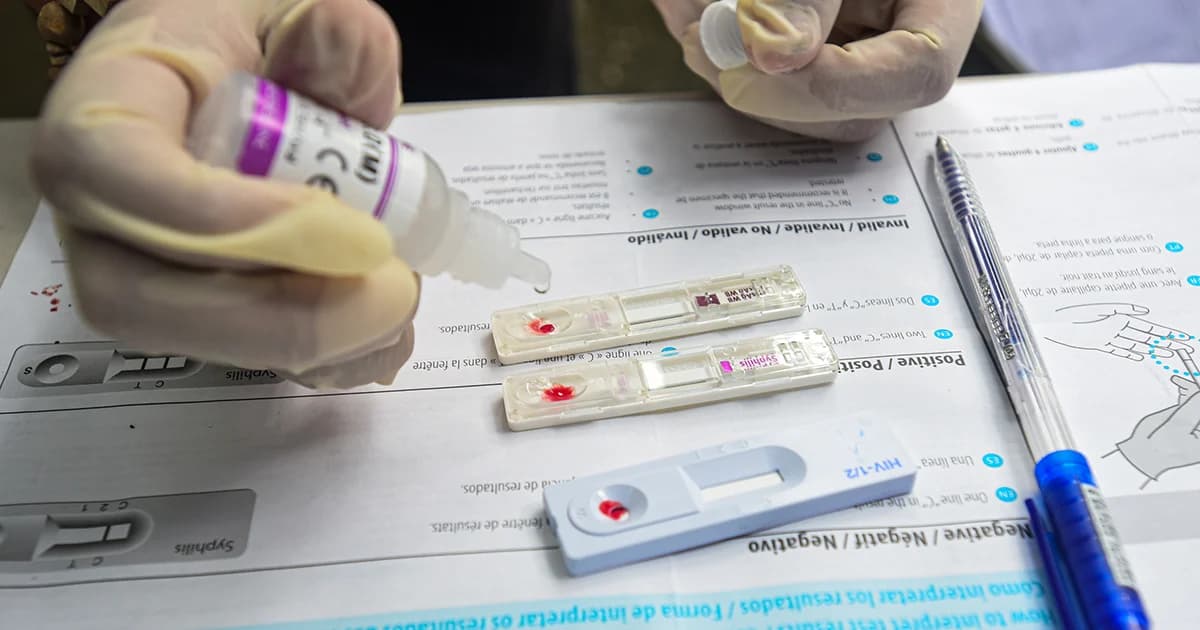 ไวรัส HIV สายพันธุ์ใหม่ถูกประกาศค้นพบ ช่วยนักวิทยาศาสตร์เข้าใจ HIV มากยิ่งขึ้น