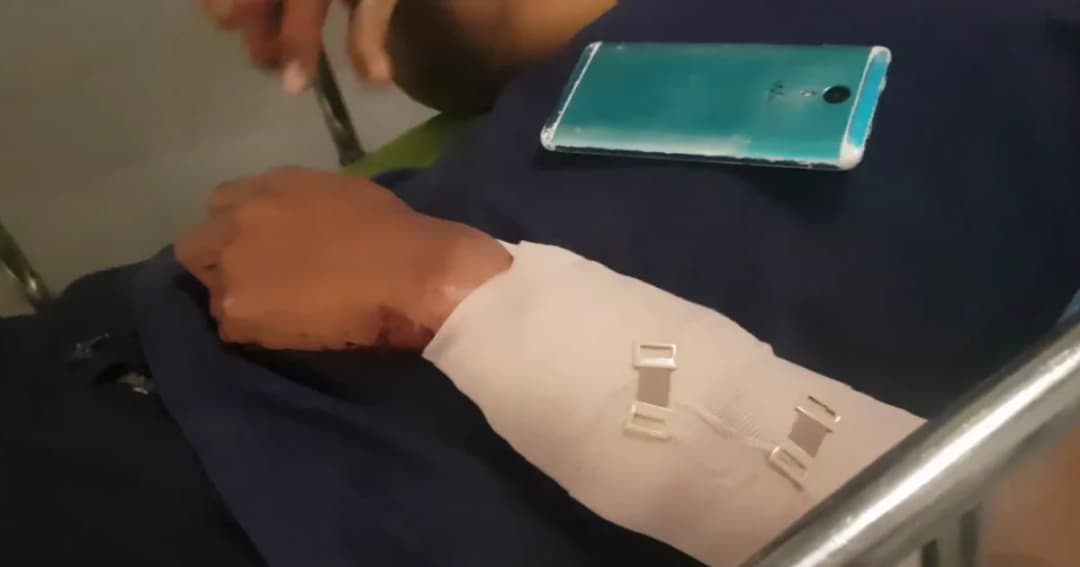 ไอ้โม่งบุกเดี่ยวฟันแขนเด็กปั้มน้ำมันชิงเงินสด 1.2 แสนหนี