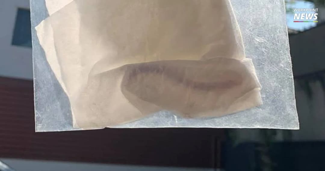 พบพยาธิไส้เดือนยาว 6 นิ้วในคอหนุ่มนักกล้าม คาดกินผักสดล้างไม่สะอาด