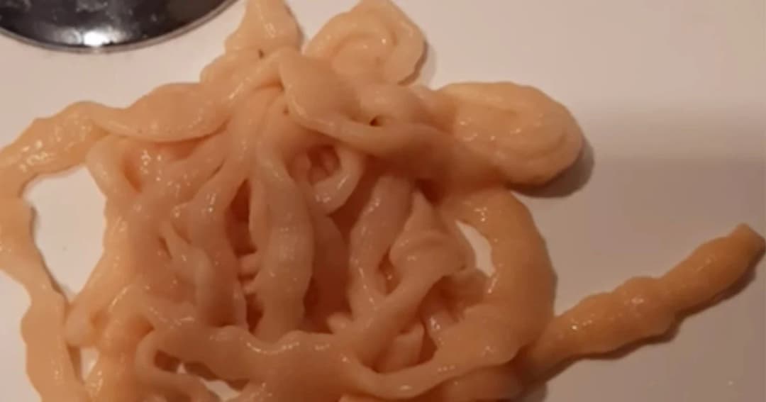 หนุ่มใหญ่งง โพสต์รูปพยาธิตัวตืด ถามอะไรมาอยู่ในตัว?