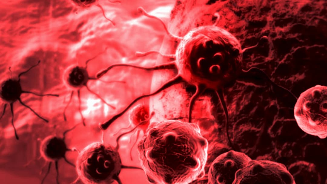 แพทย์รามาฯ เผยสถิติ 6 มะเร็งที่คนไทยป่วยสูงสุด