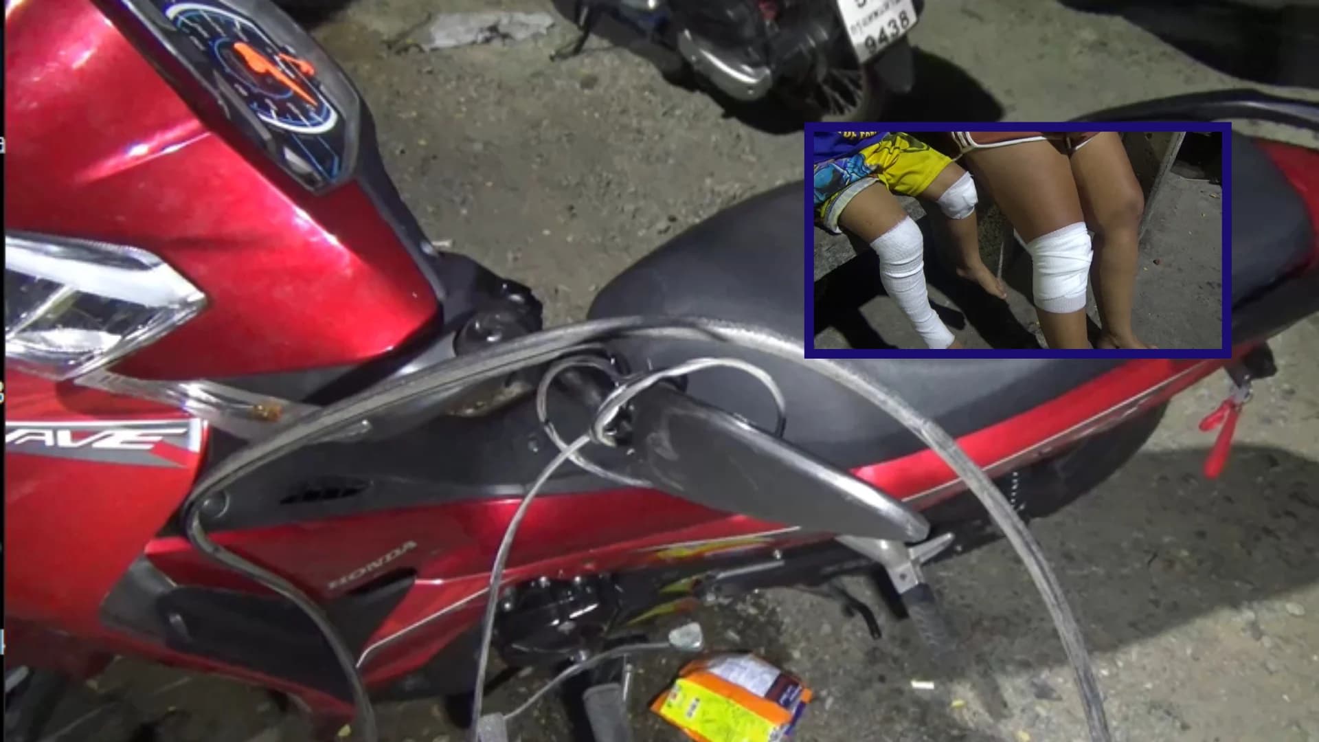 จักรยานยนต์ถูกสายเคเบิลเกี่ยวล้ม หญิงคนขับ-เด็ก บาดเจ็บ 4 คน