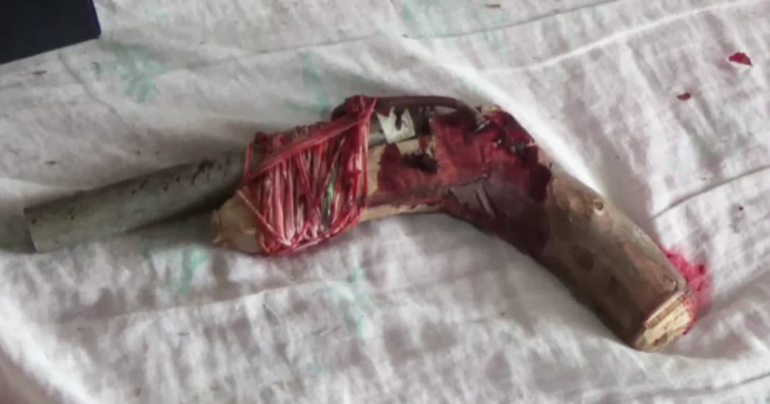 หนุ่มใหญ่นิสัยดีป่วยจิตเวช 36 ปี เคยคิดสั้นมาแล้ว 2 ครั้ง แต่ครั้งนี้ใช้ปืนประดิษฐ์เองยิงตัวดับ