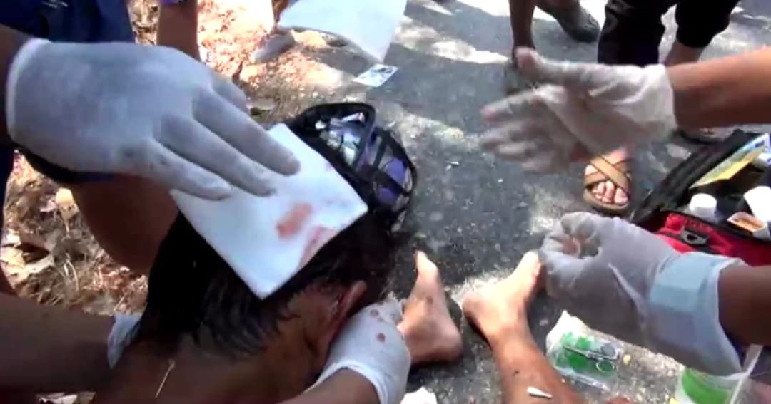 ถุงคลุมหัว อุ้มขึ้นเก๋ง กลุ่มชายอ้างเป็น ตร. ใช้มีด-ค้อนทำร้ายหนุ่มใหญ่สาหัส