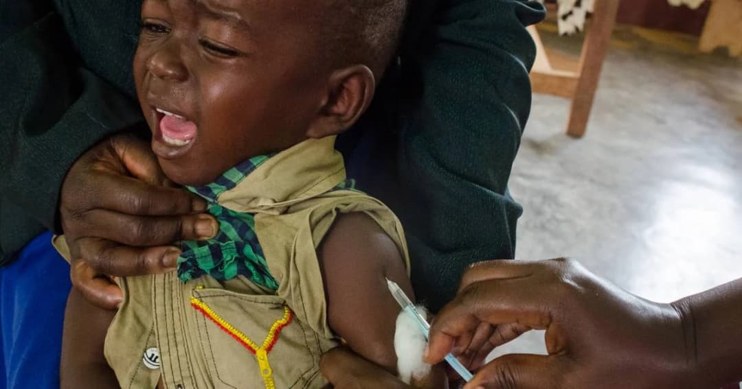 พบผู้เสียชีวิตจากโรคหัดระบาดในดีอาร์ คองโก แล้วกว่า 6 พันราย