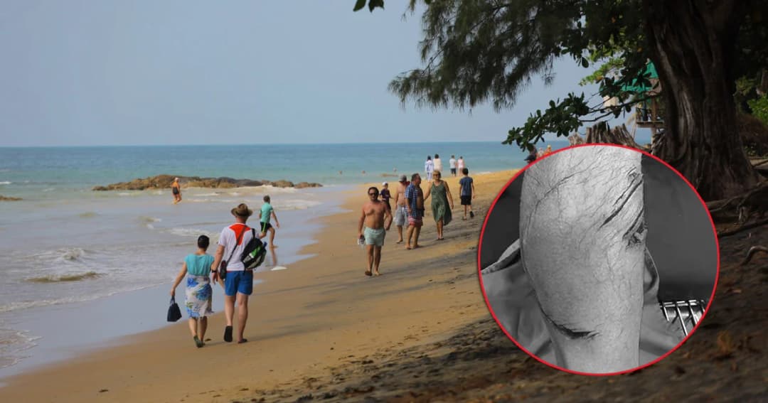 ฉลามกัดนทท. ดร.ธรณ์ แนะไม่ต้องทำข่ายกั้นแต่ให้เพิ่มความระมัดระวัง