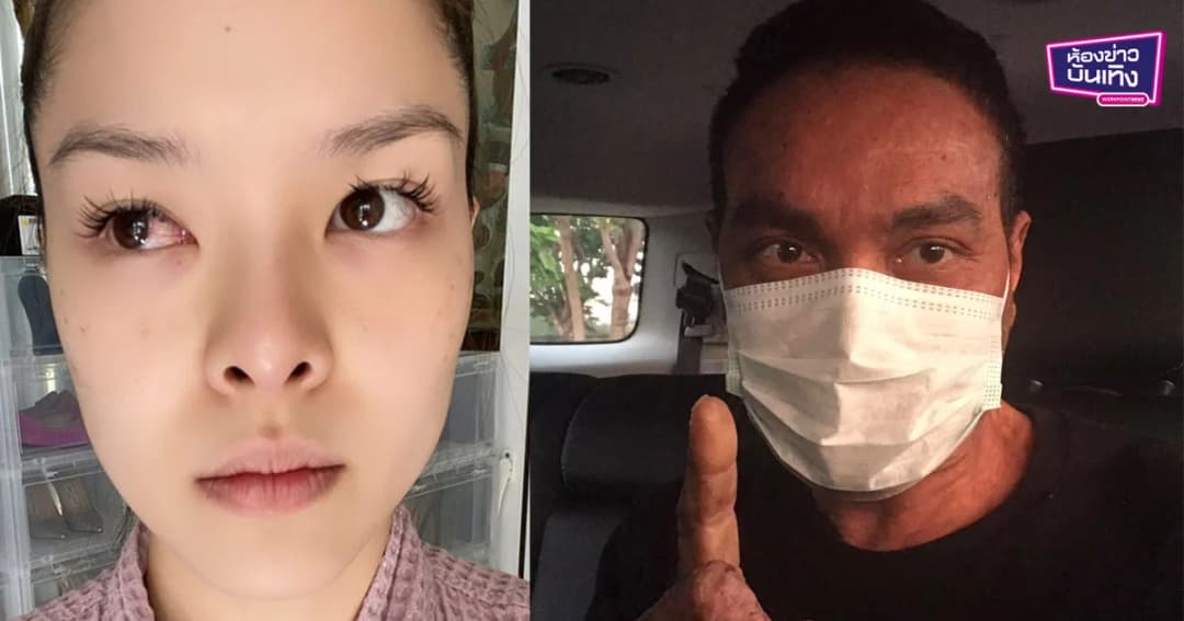 เหล่าคนดังโอด เจอฝุ่น PM 2.5 ส่งผลต่อสุขภาพ