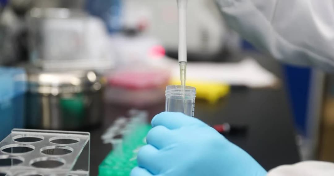 จีนอนุมัติชุดทดสอบแอนติบอดี เพื่อการตรวจหาเชื้อไวรัสโควิด-19 ได้อย่างรวดเร็ว