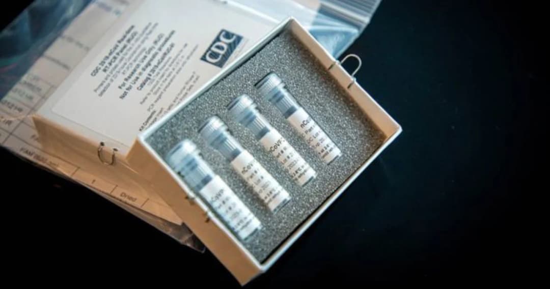 สหรัฐฯ ยอมรับชุดทดสอบไวรัสโควิด-19 มีไม่เพียงพอ