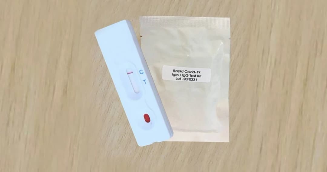 จุฬาฯ คิดค้นชุดตรวจ Chula COVID-19 Strip Test เริ่มใช้ 30 มี.ค.นี้