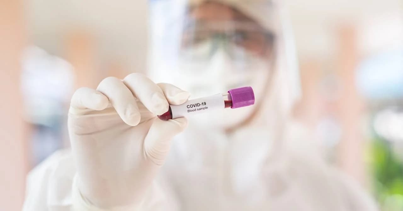 สรุป 4 หลักเกณฑ์ผู้เข้ารับการตรวจหาเชื้อ COVID-19 ฟรี รัฐออกเงินให้