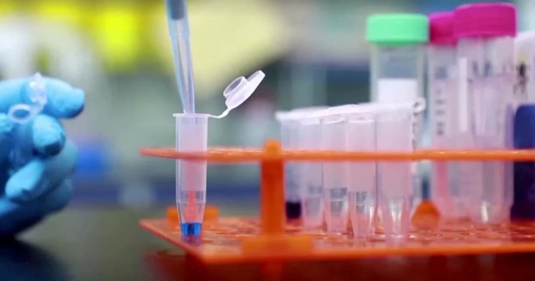 แพทย์ผิวหนังเตือนโรคโควิด-19 อาจทำให้เกิดความผิดปกติทางผิวหนัง