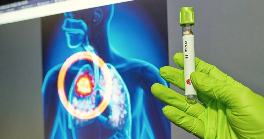 อธิบายผลกระทบต่อปอด จากเชื้อไวรัสโควิด-19