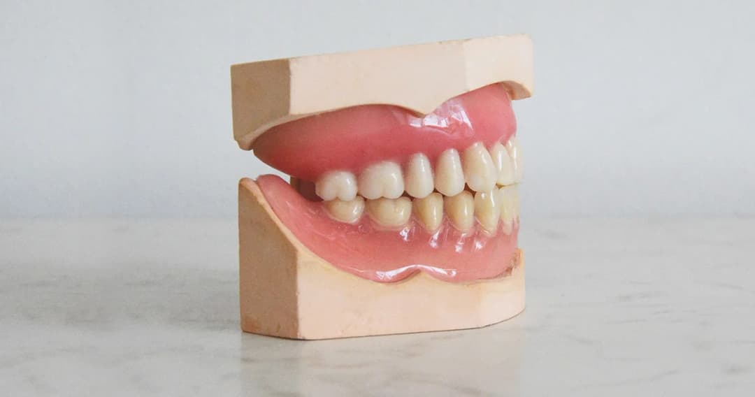 สธ.เตรียมเปิดบริการทันตกรรมใน รพ. กลุ่มนัดรักษาต่อเนื่อง