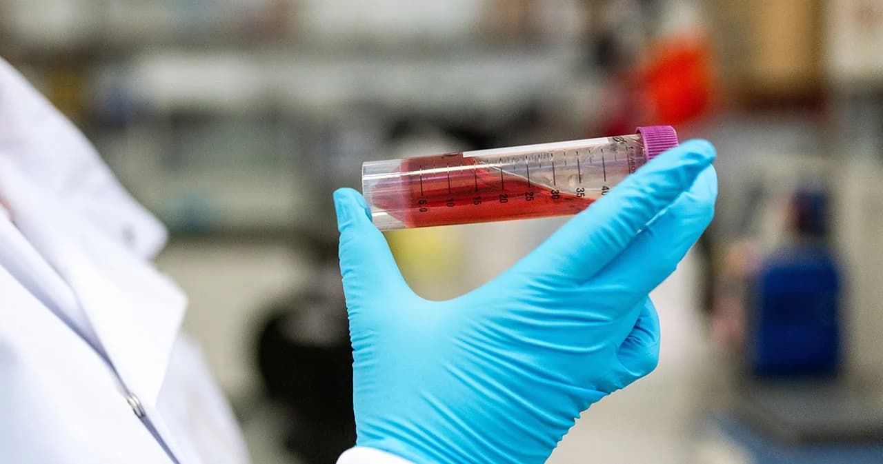 ม.อ.หาดให้ใช้พลาสมาจากผู้เคยผู้ป่วยโควิด-19 รักษาผู้ป่วยปอดอักเสบสำเร็จ