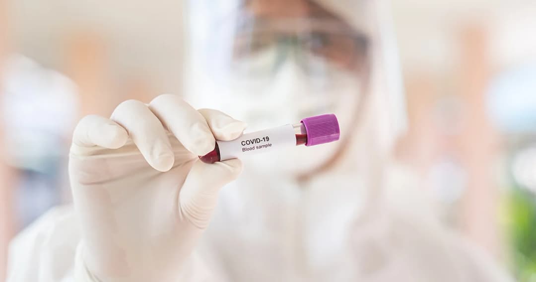 ไทยพบผู้ติดเชื้อโควิด-19 เพิ่ม 5 รายกลับจากต่างประเทศ เหลือผู้ป่วยกำลังรักษา 75 ราย