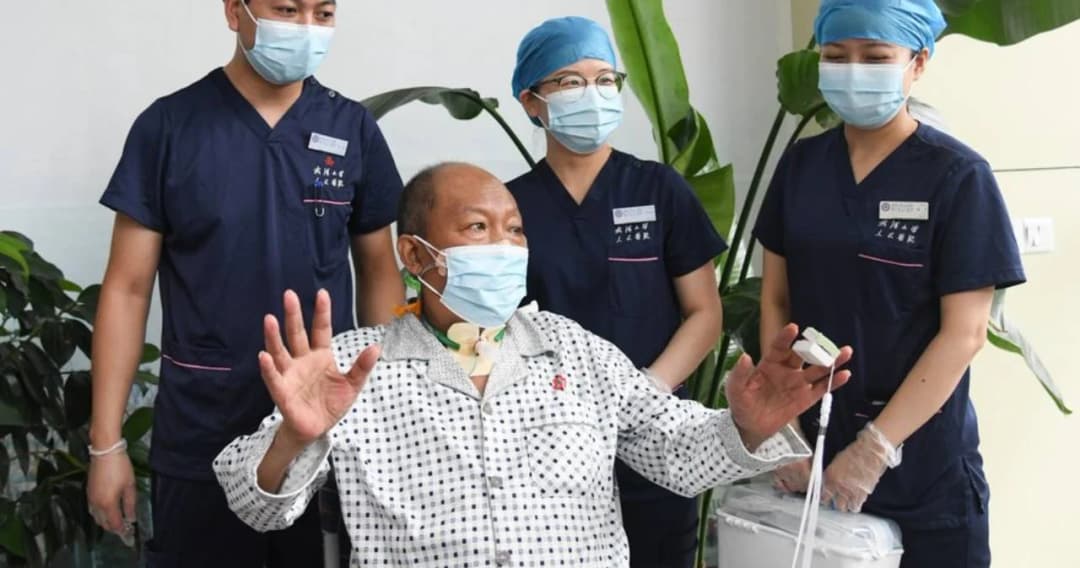 ลุงชาวจีนวัย 65 ปี ป่วยโควิดต้องเปลี่ยนถ่ายปอด คนแรกของโลกที่ออกจาก รพ.ได้