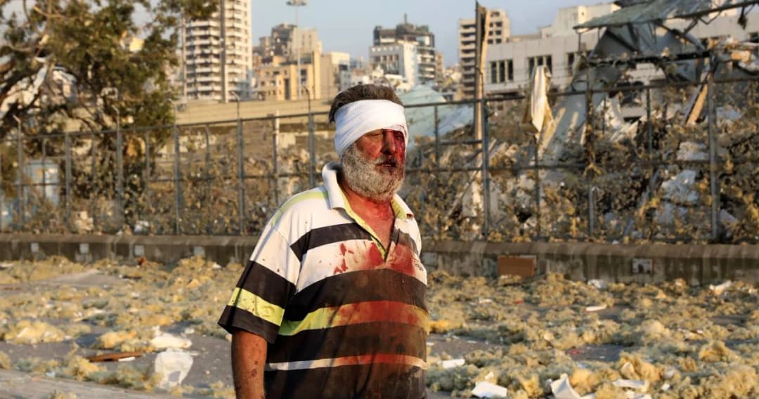 ตุรกีเสนอเตรียมสร้างโรงพยาบาลสนามช่วยเหลือผู้บาดเจ็บจากเหตุระเบิดในเลบานอน