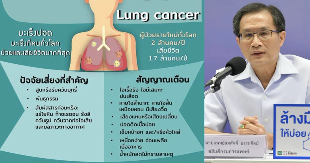 สธ.แนะวิธีสังเกตมะเร็งปอด ชี้ถ้าตรวจเจอรักษาเร็ว ลดความเสี่ยงได้