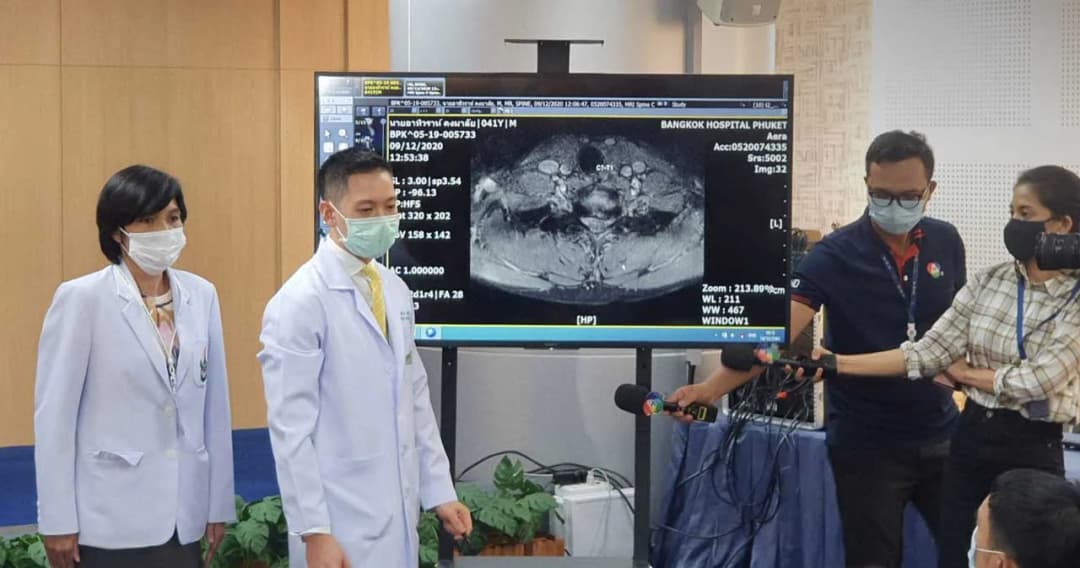 กรมการแพทย์เตือนปวดคอเรื้อรัง ระวังโรคหมอนรองกระดูกคอทับเส้นประสาท