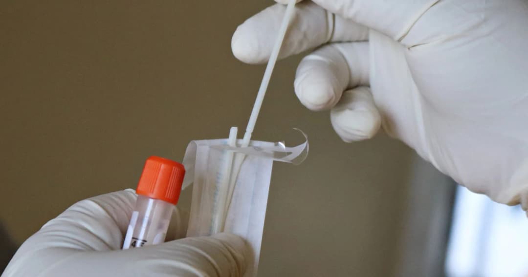 โควิดไทยทำสถิติสูงสุดติดเชื้อเพิ่ม 5,533 ราย เสียชีวิต 57 ราย ประชาชนฉีดวัคซีนแล้ว 10.4%