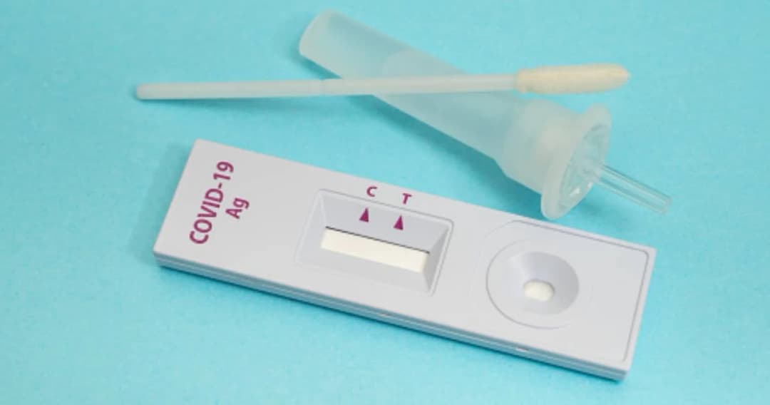 อย. แจง Antigen Test Kit 8.5 ล้านชุด ทดสอบใช้จริง มีประสิทธิภาพ