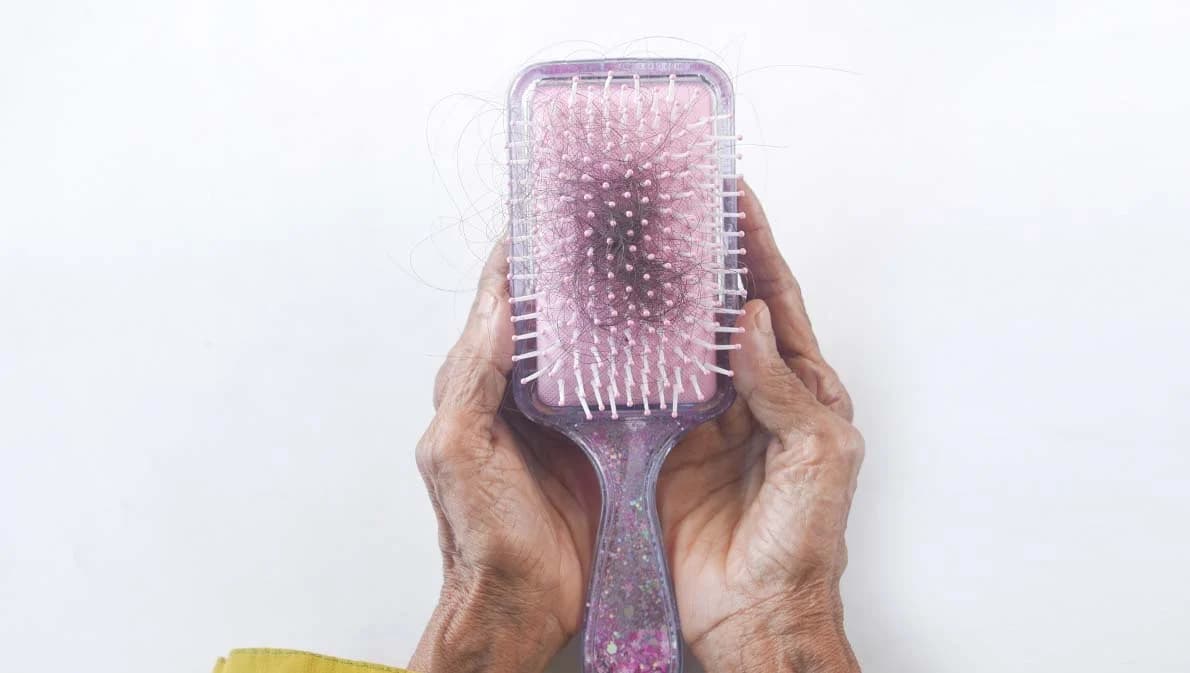 ผมร่วงหมดหัว! หนุ่มวัย 19 ปีเชื่อเป็นอาการแพ้วัคซีน แพทย์ชี้ ‘ภาวะผมร่วง’ เกิดขึ้นได้หลังติดโควิด