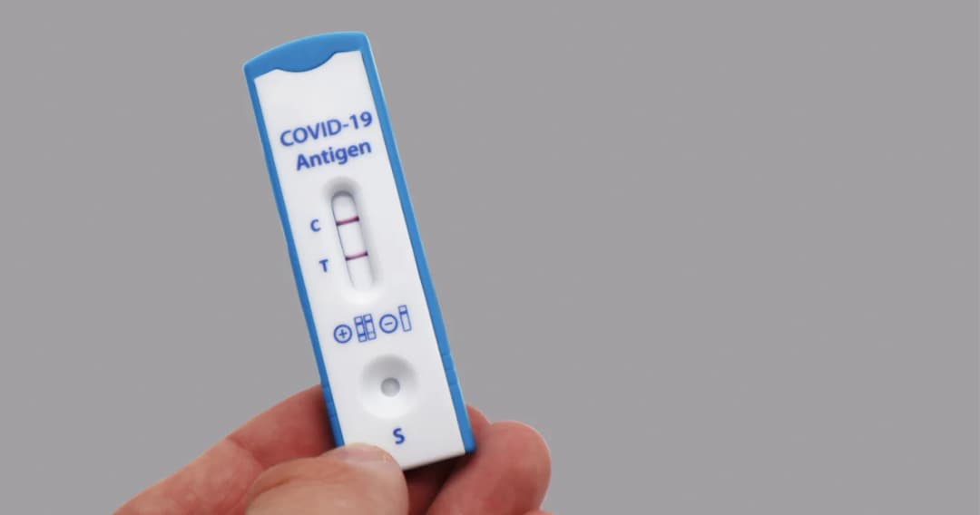 แนวปฏิบัติ สงสัยติดโควิด-19 ต้องทำยังไง