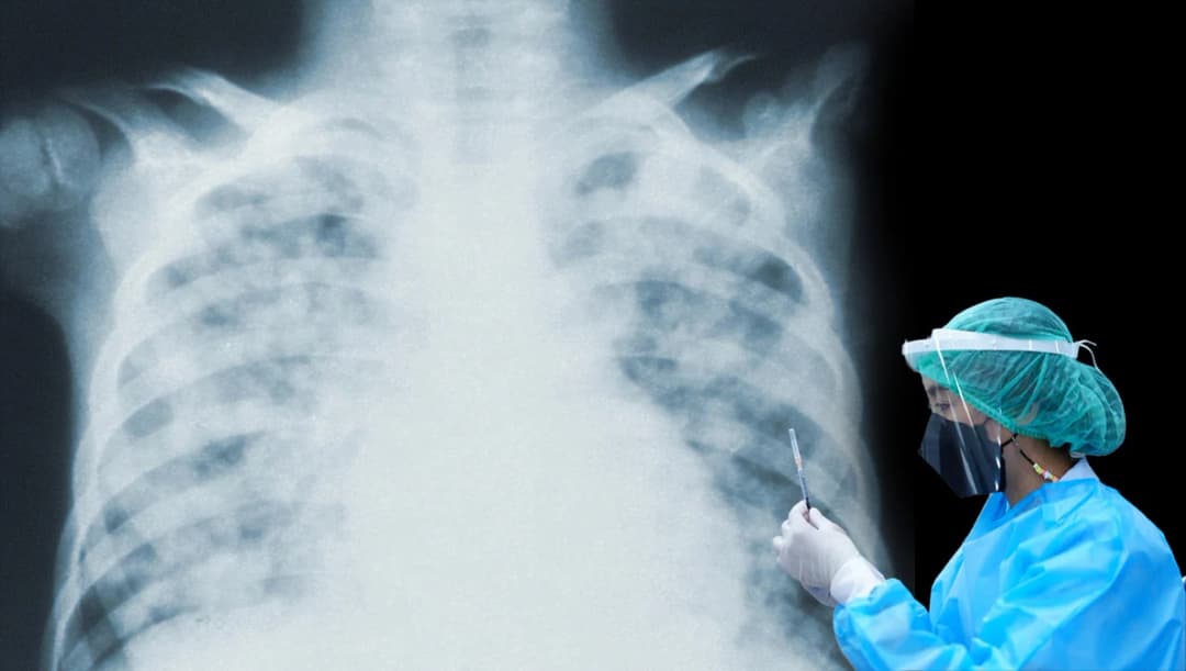 ไทยติด ‘โอไมครอน’ เพิ่มขึ้นทุกภาค ศบค.คาดหลังสงกรานต์ผู้ป่วยปอดอักเสบเพิ่ม 2,000 คน/วัน