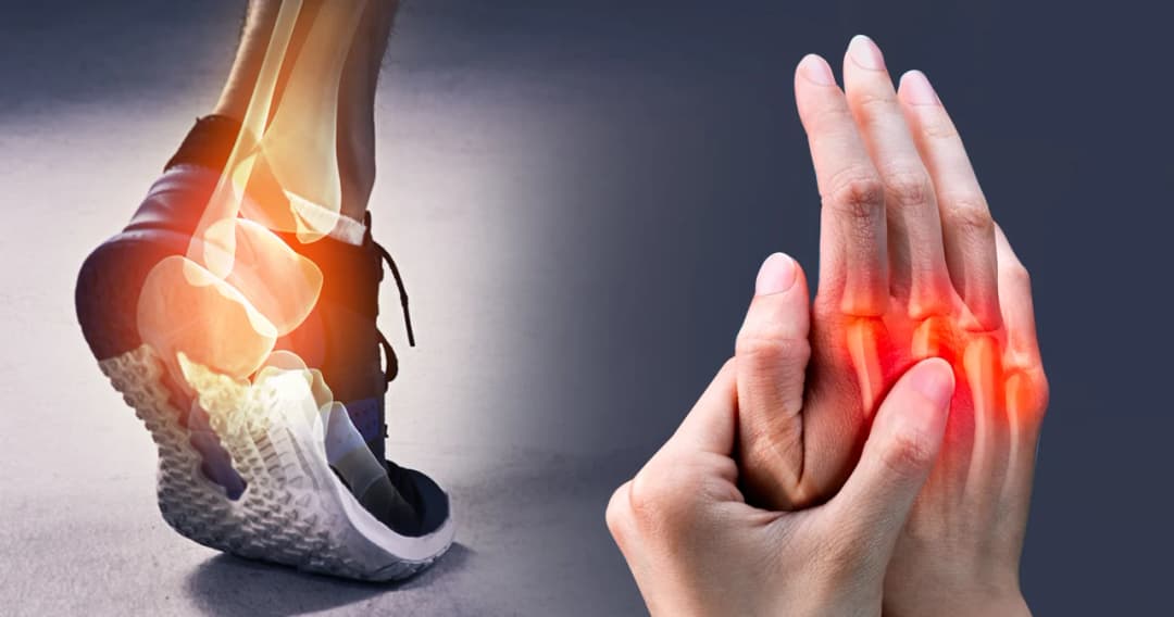 ชวนคุยกับแพทย์ ในวันที่ “ปวดเท้า – ปวดมือ” กลายเป็นอาการยอดฮิตของการใช้ชีวิตยุคใหม่