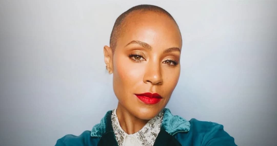 ทำความรู้จัก Alopecia โรคผมร่วงเป็นหย่อม