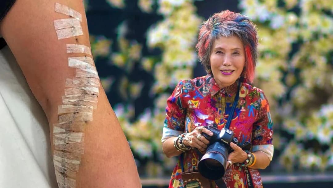 สรุปคดี ‘แตงโม’ ยังไม่สมบูรณ์ ชาวเน็ตจับโป๊ะเคสต่างชาติที่ ตร.เทียบไม่ใช่แผลใบพัด