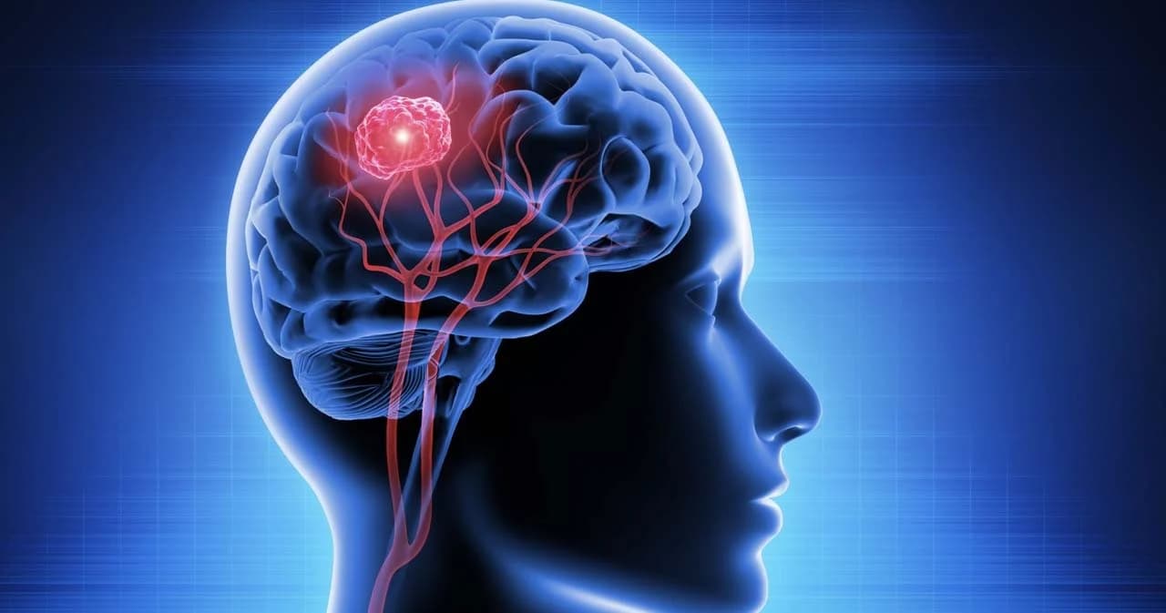 นวัตกรรมพิชิตมะเร็ง ‘ระบบส่งยาฉีดรักษามะเร็งสมองจากเจลชีวพอลิเมอร์’ ฝีมือนักวิจัยไทย