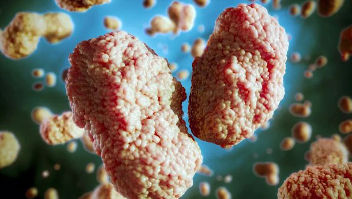 ‘ฝีดาษลิง’ ตรวจพบเร็ว ลดความเสี่ยงแพร่ระบาด