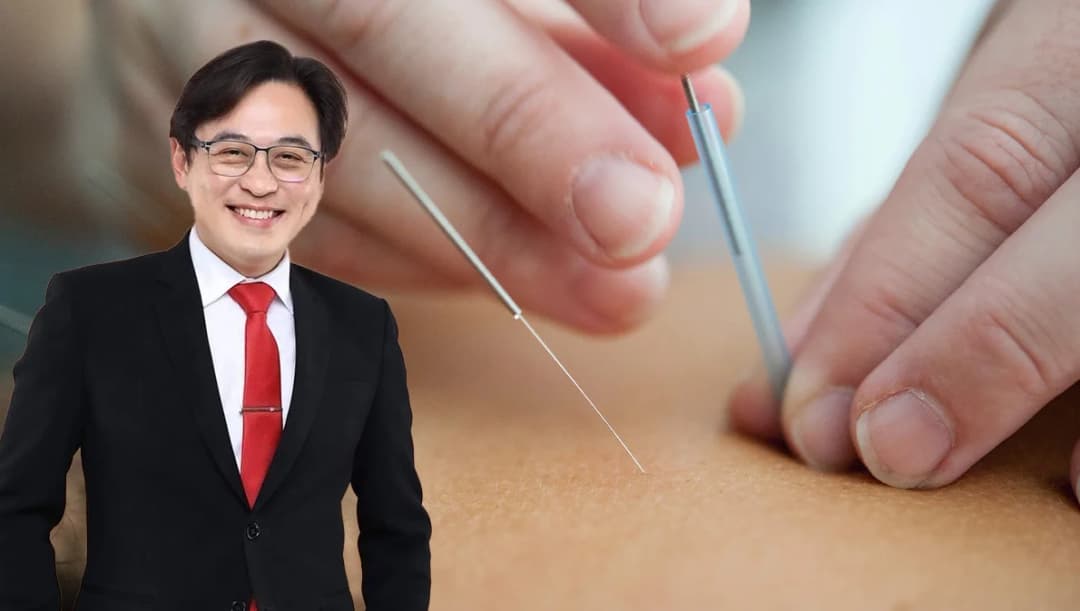 แพทย์แนะ ‘ฝังเข็ม’ ช่วยปรับสมดุล บำบัดฟื้นฟูผู้ป่วย