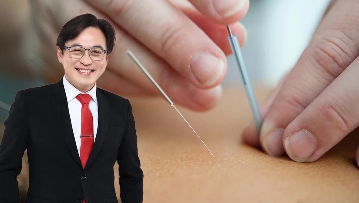 แพทย์แนะ ‘ฝังเข็ม’ ช่วยปรับสมดุล บำบัดฟื้นฟูผู้ป่วย