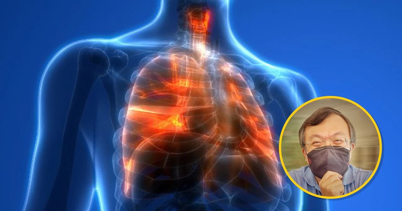 ‘กัญชาไฟฟ้า’ ขายว่อนโซเชียล ‘หมอธีระ’ เตือนเสี่ยงปอดอักเสบรุนแรง ถึงขั้นเสียชีวิต