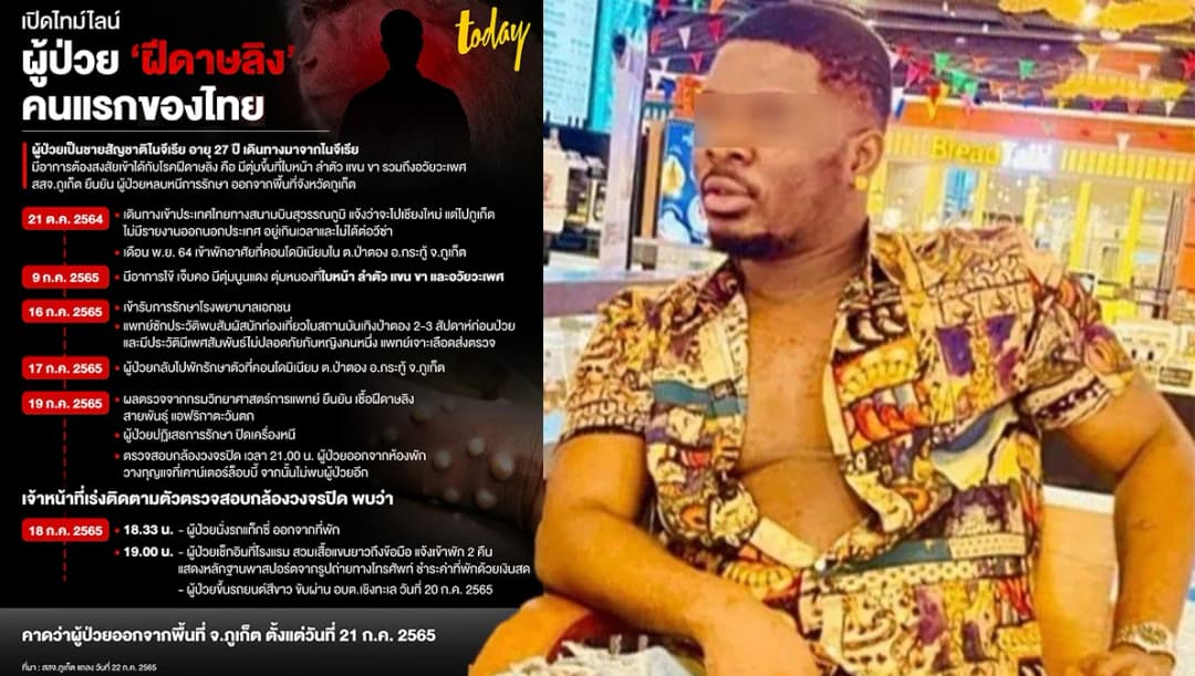 ชายป่วย ‘ฝีดาษลิง’ หนีการรักษาโผล่ จ.สระแก้ว คาดเตรียมหนีออกชายแดน