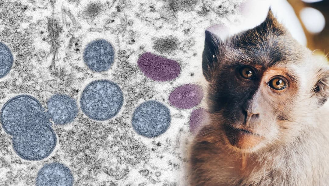 ‘ฝีดาษลิง’ ยากที่จะควบคุมหรือกำจัดให้หมดไป นายกฯ สั่ง สธ.หามาตรการรับมือด่วน