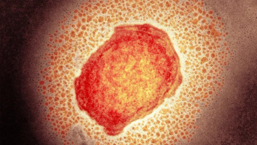 กรมวิทย์ฯ เผยผลตรวจสงสัยฝีดาษลิง เคสตราด-อีสาน ผลเป็นลบ 